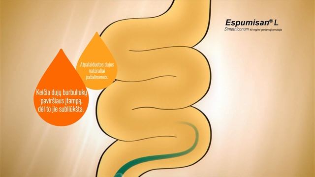 Espumisan L смотреть онлайн