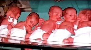 23 летняя девушка родила детей, которые рождаются раз в миллион лет!