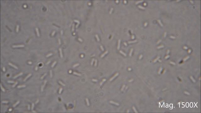 Bacteria under the Microscope (E. coli and S. aureus) смотреть онлайн
