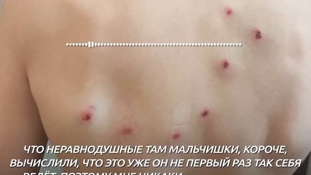?? В Калининграде школьник-мигрант расстрелял из страйкбольного автомата более младшего русского г