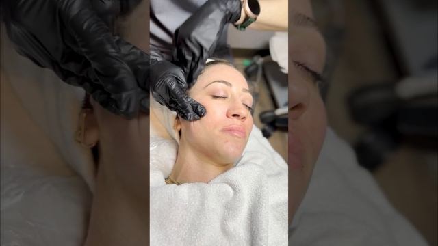 PRX-T33 BioLift: Transform Your Skin at AdmireMD Skin Clinic in Scottsdale, AZ! смотреть онлайн