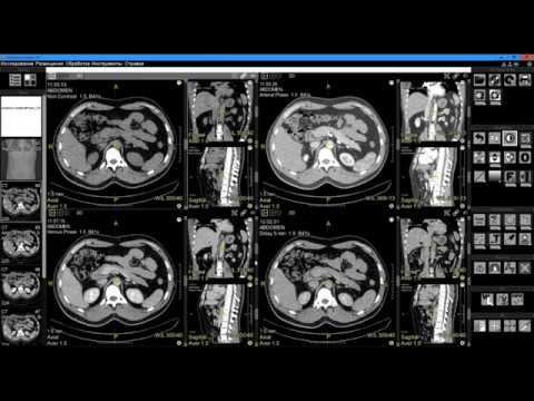 Вывод исследований на экран в Vidar Dicom Viewer смотреть онлайн