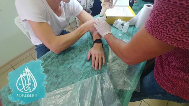 Хиджама на руки. Практика ученика смотреть онлайн