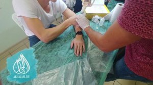 Хиджама на руки. Практика ученика