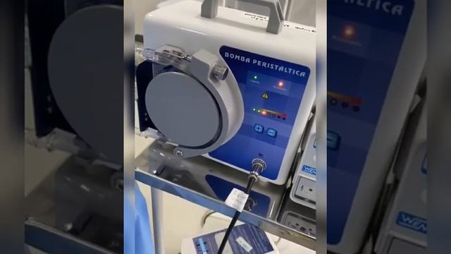 Bomba peristáltica, utilizada para diminuir sangramentos e complicações em uma abdominoplastia. смотреть онлайн