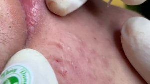 Most Satisfying and Relaxation with An Spa Video #887