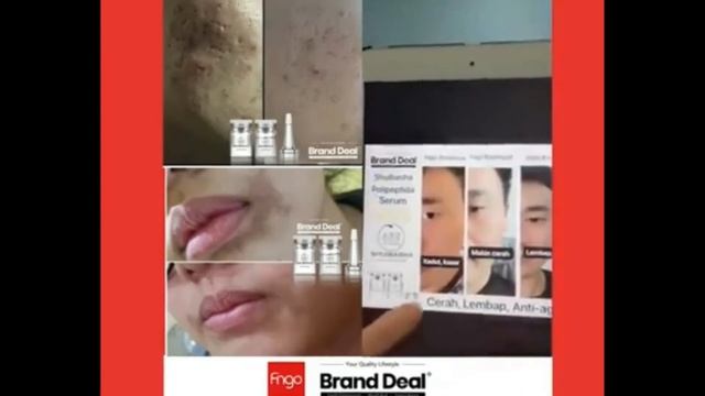malaysia no1 ready stok shuibasha anti-aging polypeptide essence | +60196025642| kelebihan shuibash смотреть онлайн