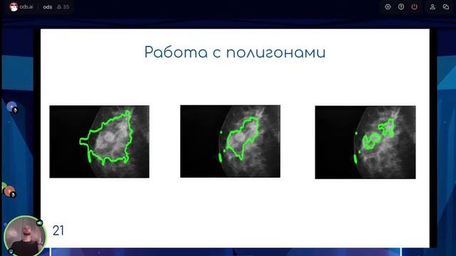 Data Fest 2021 - Ужасы медицинских данных смотреть онлайн
