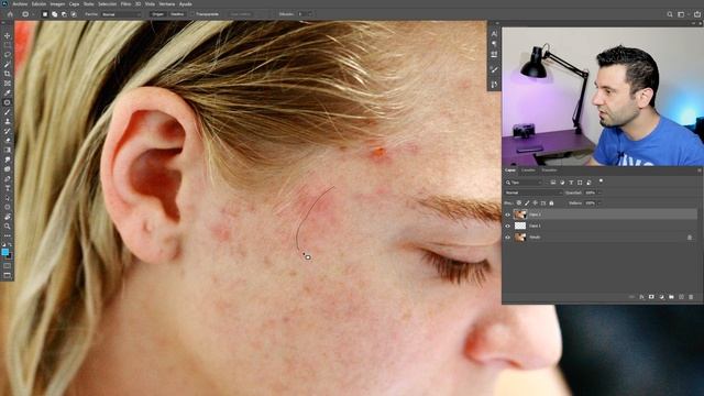 3 Pasos para Quitar Granos de Acné en Photoshop смотреть онлайн