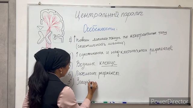 ОТЛИЧИЕ ЦЕНТРАЛЬНОГО И ПЕРИФЕРИЧЕСКОГО ПАРАЛИЧА- Difference Between Central Peripheral Palsy.