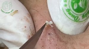 Fascinating Your Day with Thuy Dung Spa Videos #026