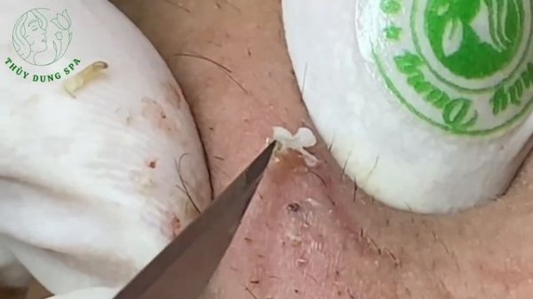 Fascinating Your Day with Thuy Dung Spa Videos #026