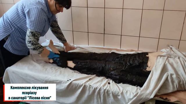 Лікування псоріазу в санаторії "Лісова пісня" смотреть онлайн