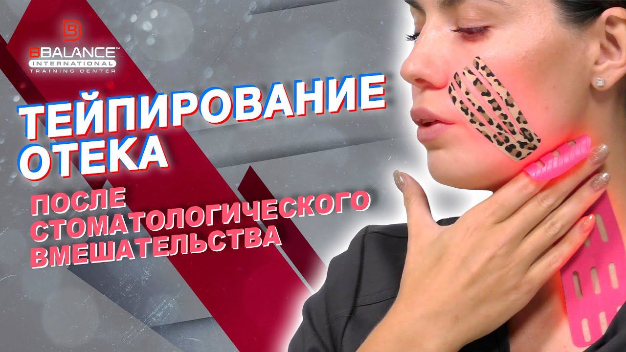 ✅ ТЕЙПИРОВАНИЕ ОТЕКА ПОСЛЕ СТОМАТОЛОГИЧЕСКОГО ВМЕШАТЕЛЬСТВА | Сания Абдрахманова | BBALANCE смотреть онлайн