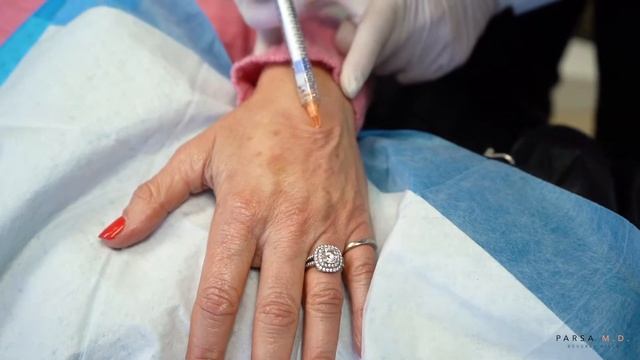 Los Angeles Radiesse Hand Treatment | Beverly Hills Filler for Bony Hands | Kami Parsa, M.D. смотреть онлайн