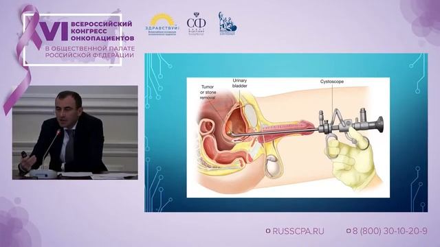 Панахов Анар Давудович - Подходы к диагностике и лечению рака мочевого пузыря смотреть онлайн