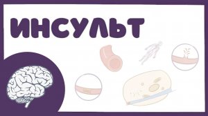 Инсульт - причины, симптомы, лечение (неврология лекция)