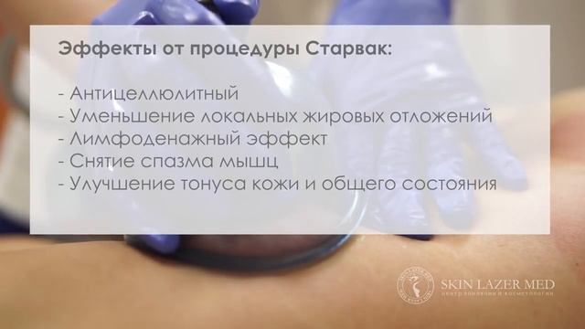 Вакуумно роликовый массаж Старвак Starvac для коррекции фигуры 7