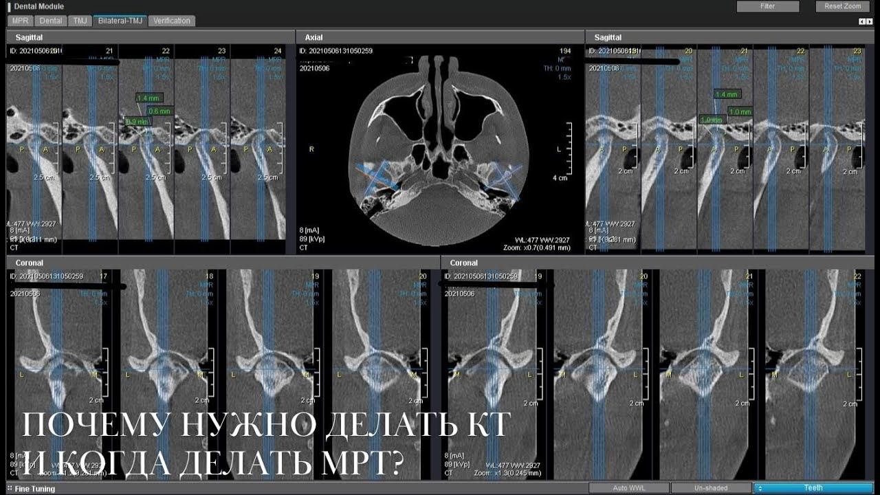 Почему для консультации нужно делать КТ, и когда нужно делать МРТ? смотреть онлайн