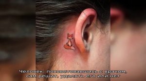 За ухом шарик - что это?