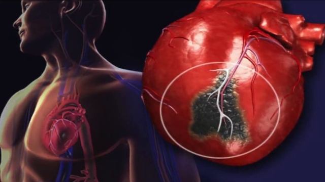 क्या BP की दवा से हार्ट को खतरा ? || BETA BLOCKER HEART MEDICINES POSE SPECIAL RISKS смотреть онлайн
