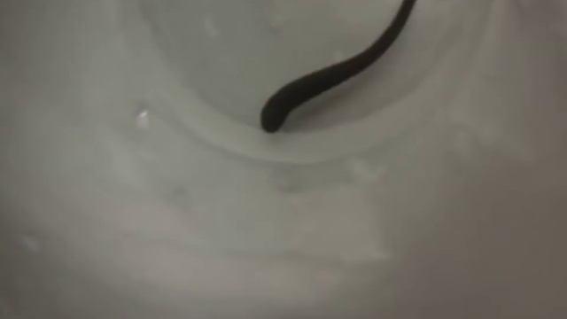 Как лечиться пиявками. Leeches. Les sangsues. смотреть онлайн