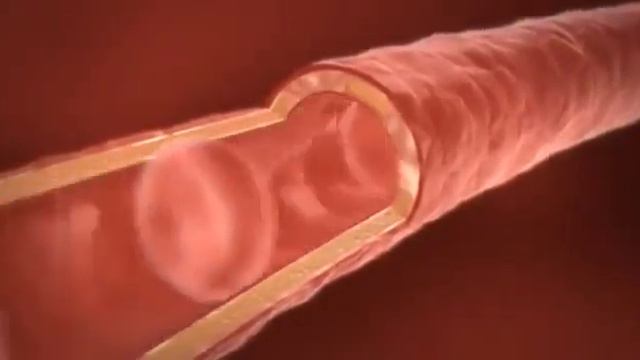 как работает Алоэ Вера Форевер смотреть онлайн