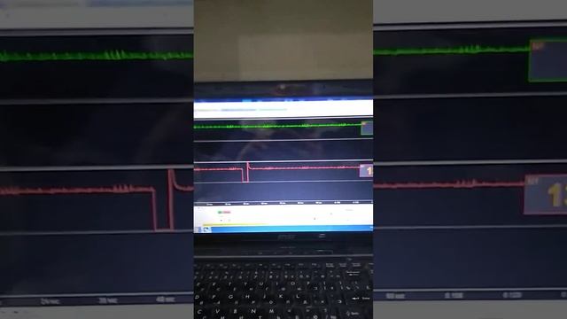 BMW E46 M50 торит, Фсё поменяли и почистили а результата нет, ЧТО БУДЕМ ДЕЛАТЬ ? ОСЦИЛЛОГРАФФ СИЛА смотреть онлайн