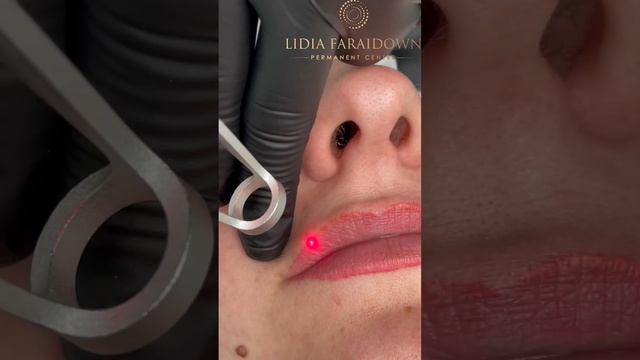 Татуаж за пределами своих губ? Лазерное удаление контура татуажа смотреть онлайн