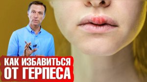 Как избавиться от герпеса? Аутофагия против вируса герпеса💪
