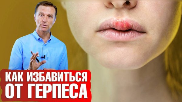 Как избавиться от герпеса? Аутофагия против вируса герпеса💪