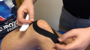 Наложение кинезио тейпа при хондромаляции надколенника.