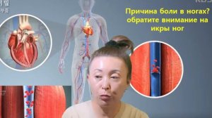 Причина боли в ногах?обратите внимание на икры ног