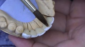 Наненсение керамики INLINE. металлокерамика программы обжига керамики. Как нанести керамический зуб?