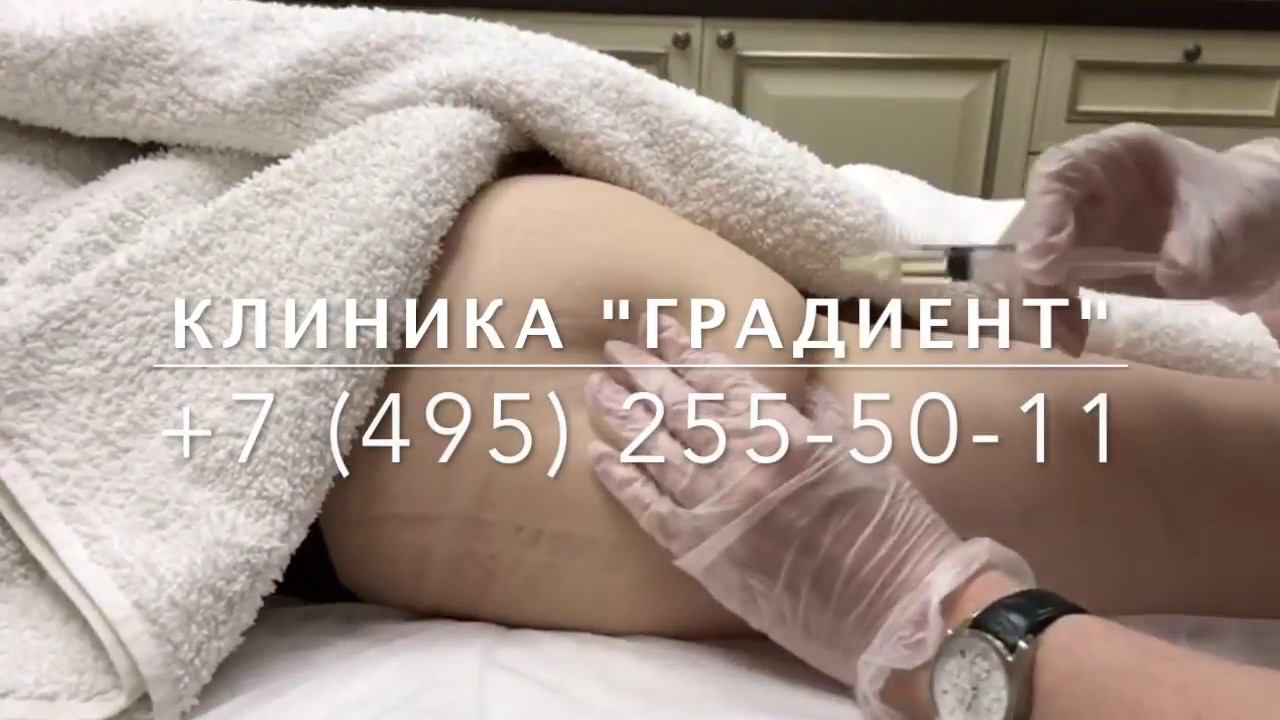 ЛИПОЛИТИКИ - уколы для похудения смотреть онлайн