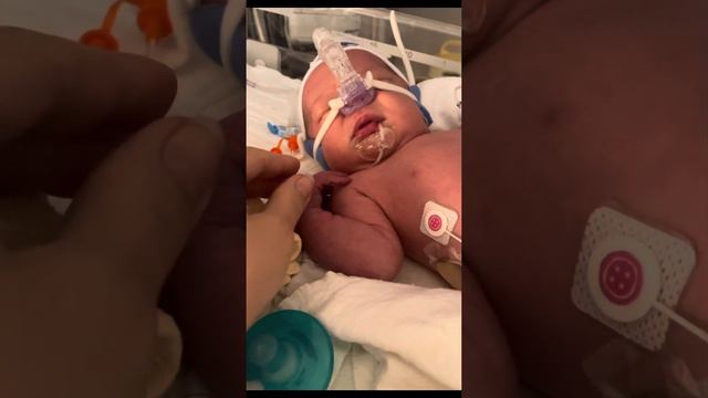 Как всё начиналось. Часть 1. Роды. СМА Тип 1. смотреть онлайн