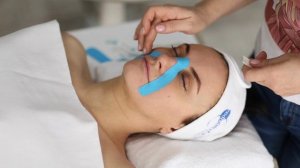 Аппликация на носогубную складку с коррекцией скуловых мышц. Эстетическое тейпирование.