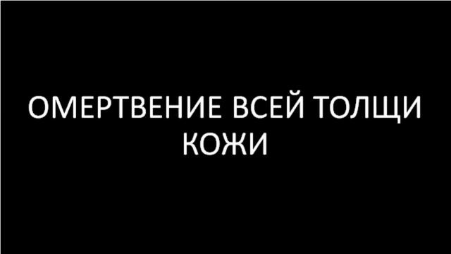 степени ожогов смотреть онлайн