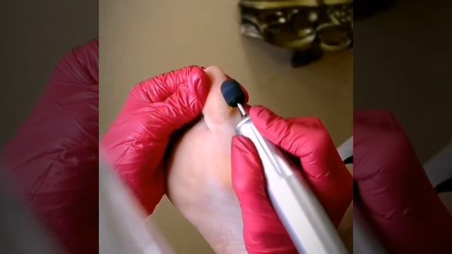 Медицинский педикюр KART смотреть онлайн