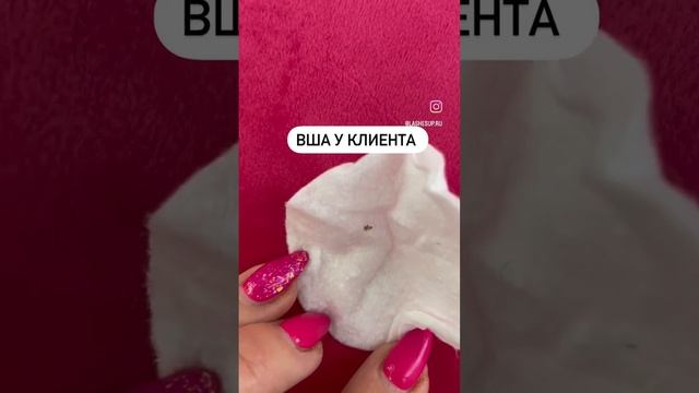 Ваше мнение ? Как сказать по вши в голове клиента ? смотреть онлайн