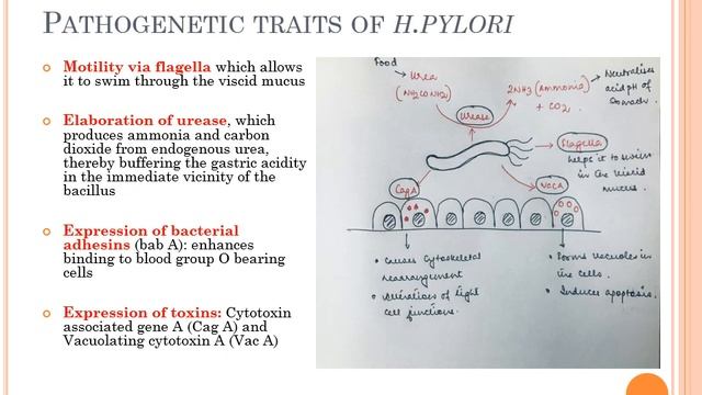 GIT 1: Gastritis and H pylori смотреть онлайн