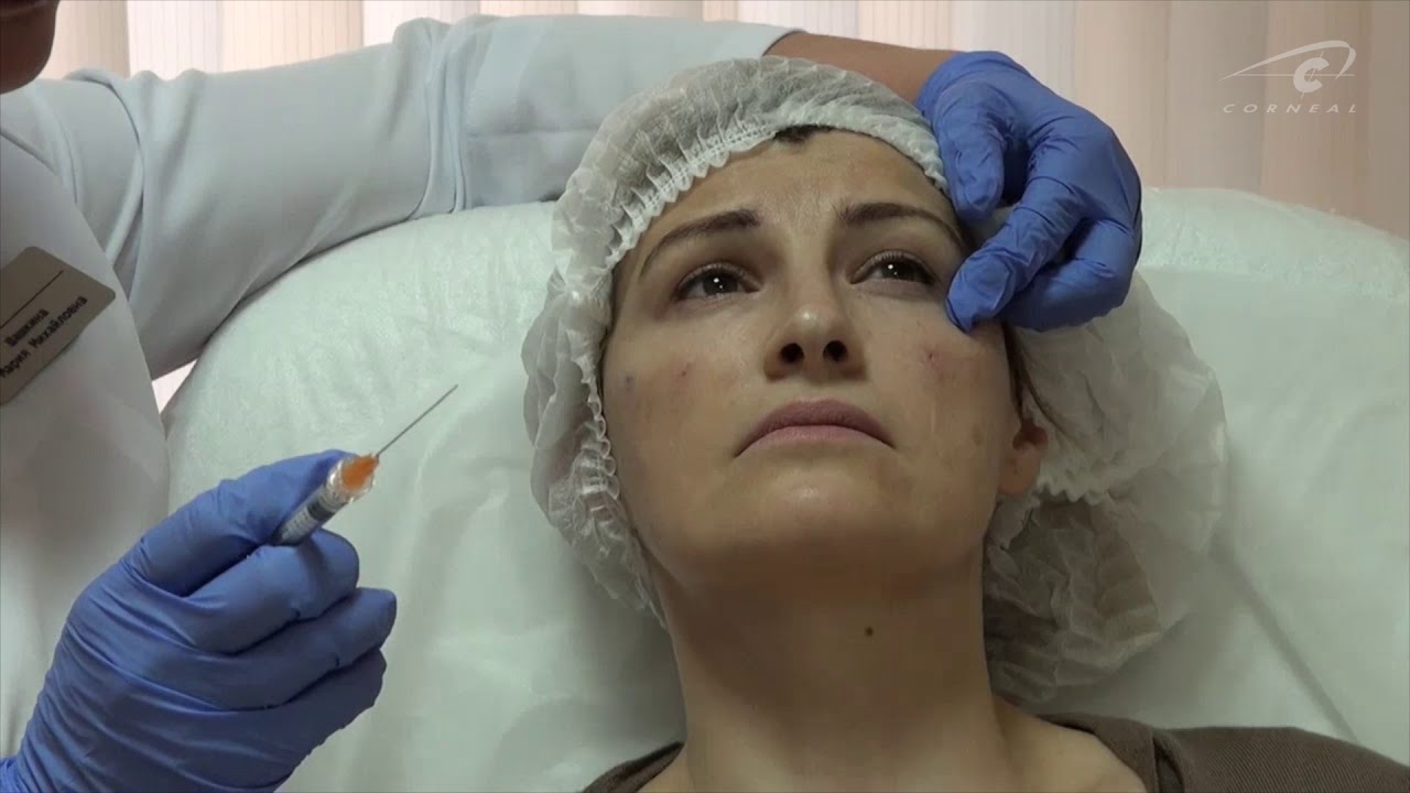 Ювелирная коррекция периорбитальной зоны смотреть онлайн