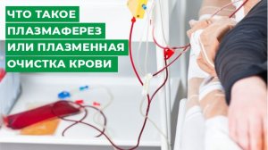 Что такое плазмаферез или плазменная очистка крови. Клиника Мирт г. Кострома.