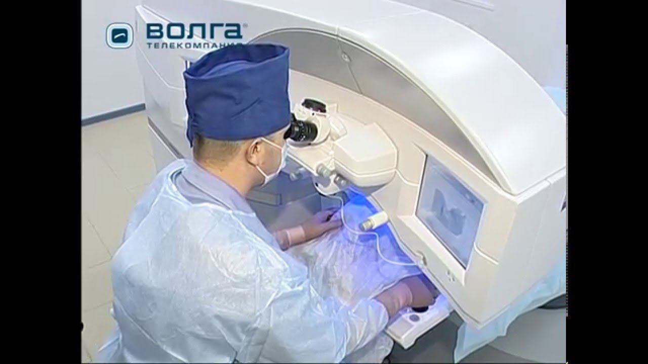 Лазерная коррекция зрения. Femto LASIK. Фемто Ласик смотреть онлайн