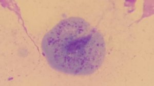 трихомониаз #трихомонады