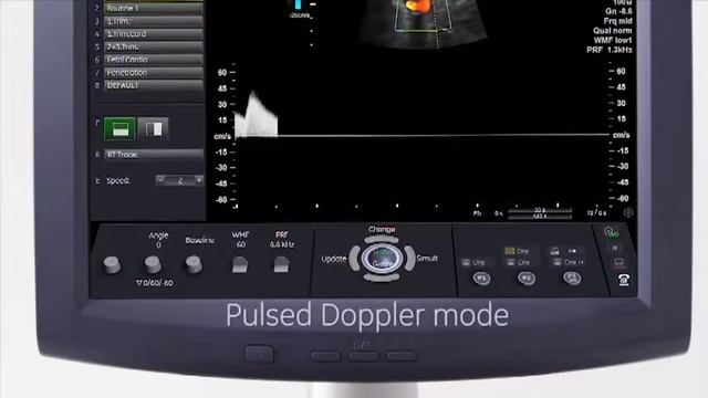 Máy siêu âm 4D Voluson P8 смотреть онлайн
