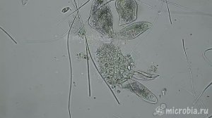 Инфузорию туфельку съедают хищные инфузории