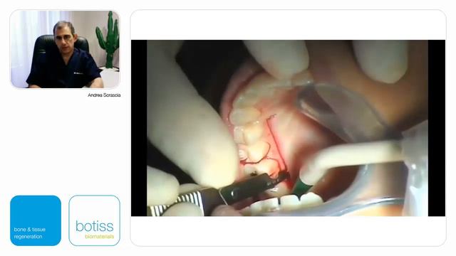 Techniques chirurgicales pour la gestion des tissus mous смотреть онлайн