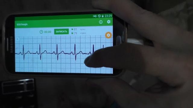 Обзор кардиофлешки ECG Dongle (ЭКГ в домашних условиях) смотреть онлайн