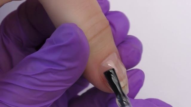 Травма ногтя. Онихолизис. Это больно смотреть онлайн